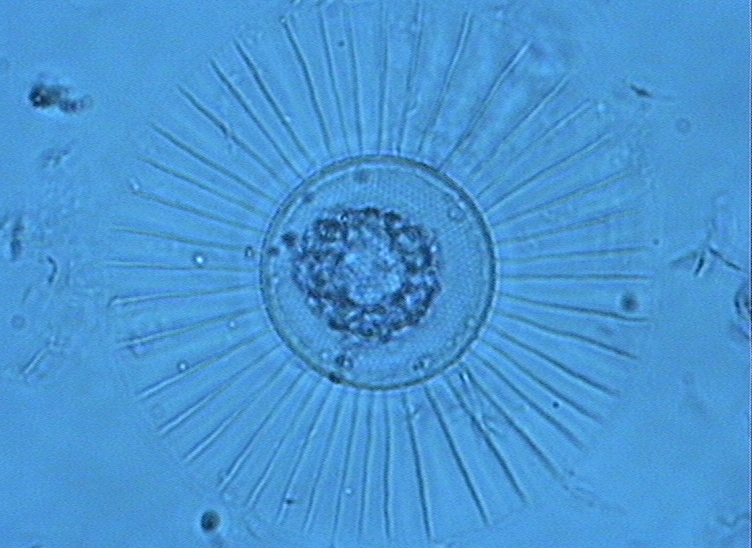 Dictyocha speculum